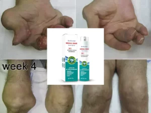 Activeme™ Joint & Bone Therapy Spray