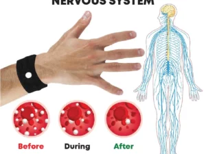 AcupointPro SugarController Wristband