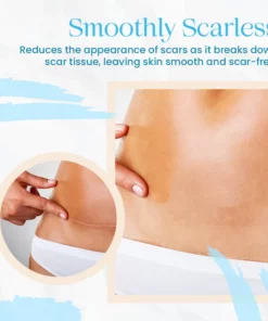 Advance Organic Scar Removing Gel