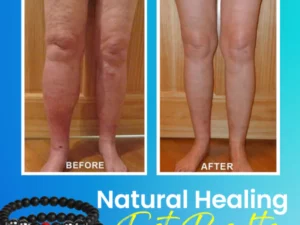 Anti-edema MagneticTherapy Obsidian Anklet