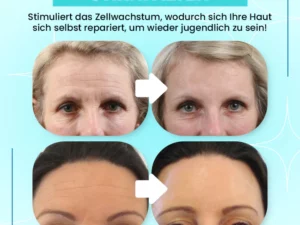 Anti-wrinkle Forehead Line Removal Gel Patch