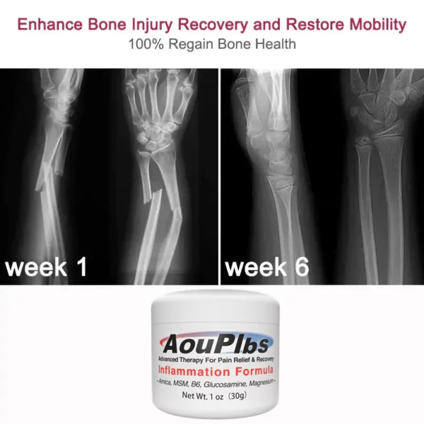 I-AouPlbs™ Joint & Bone Therapy Cream