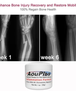 AouPlbs™ Joint & Bone Therapy Cream