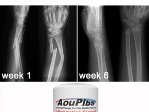 AouPlbs™ Joint & Bone Therapy Cream