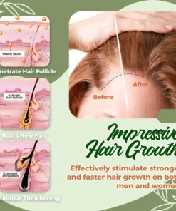 Aphrodite Herbal Hair Growth Maximizer Spray