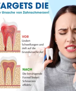 Avident™ Zahnreinigungsspray