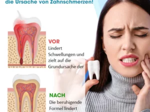Avident™ Zahnreinigungsspray