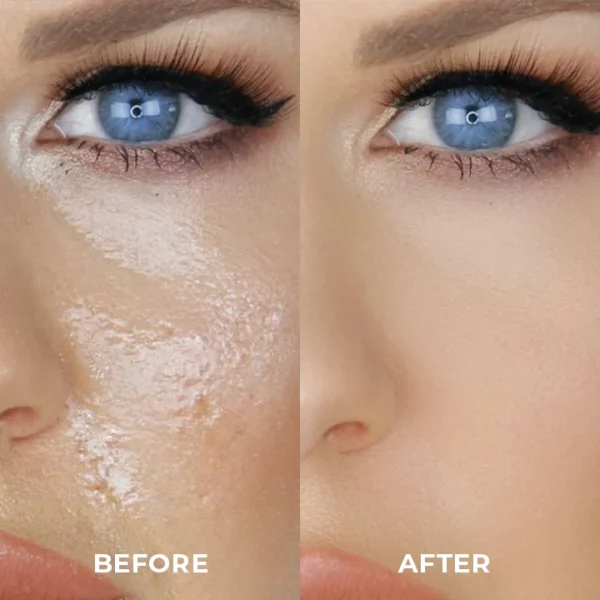 BeautyMAX™ Ölabsorbierende Vulkanstein-Rolle