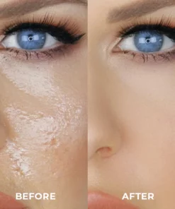 BeautyMAX™ Oil-Absorbing Volcanic Stone Roller