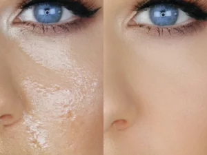 BeautyMAX™ Oil-Absorbing Volcanic Stone Roller