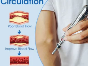 Biomicroelectric Pulse Lymphatic Massage Pen