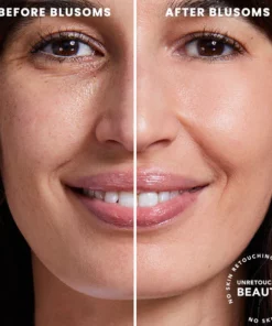 Blusoms™ Extra Renewing Rosehip Eye Balm