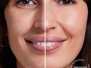 Blusoms™ Extra Renewing Rosehip Eye Balm