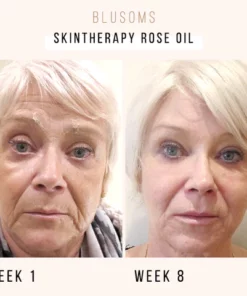 Blusoms™ SkinTherapy Rose Oil