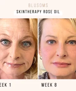 Blusoms™ SkinTherapy Rose Oil