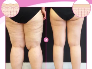 BodiPro Restore & Firm Thigh Wrap