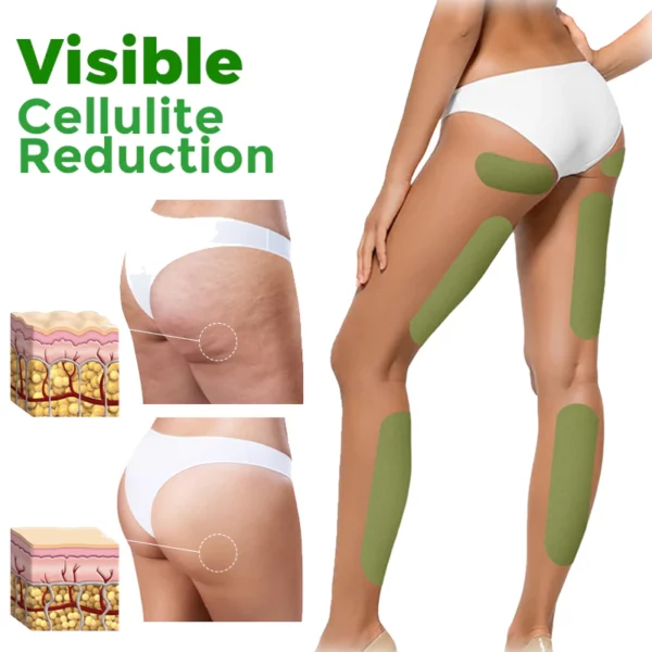 CellaFirm Patches zur Reduzierung von Cellulite