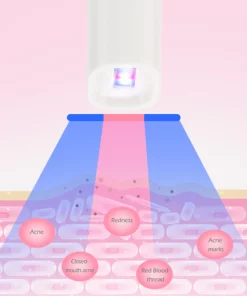 Clinical™ Blu-ray Acne Therapy Pen