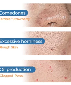 Clinical™ Bubble Cleaning Essence