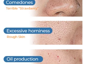 Clinical™ Bubble Cleaning Essence