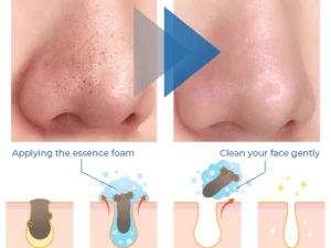 Clinical™ Bubble Cleaning Essence