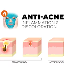 Clinical™ Thermal Therapy Gel Bead Mask