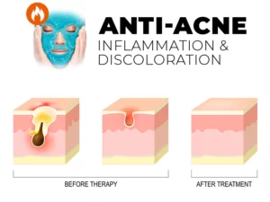 Clinical™ Thermal Therapy Gel Bead Mask