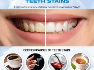 DazzleWhite Teeth Whitening Essence