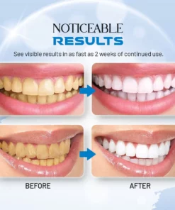 DazzleWhite Teeth Whitening Essence