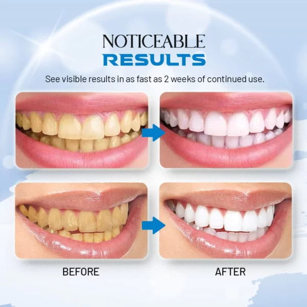 DazzleWhite Teeth Whitening Essenz