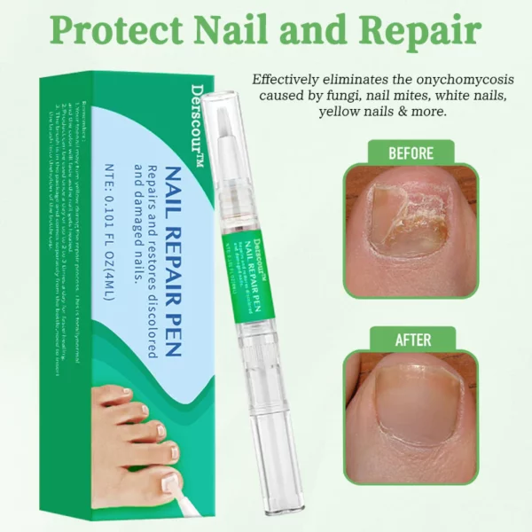 Derscour™ Anti-Fungal Treatment Nail Repair Pen