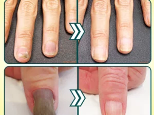 Derscour™ Anti-Fungal Treatment Nail Repair Pen