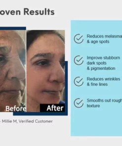 Dr.Skin™ Advanced Dark Spot Corrector & Anti-Aging Collagen Serum