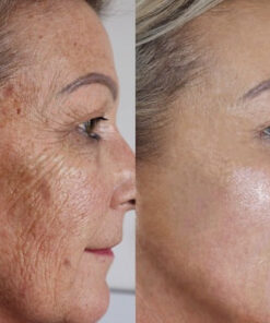 Dr.Skin™ Advanced Dark Spot Corrector & Anti-Aging Collagen Serum