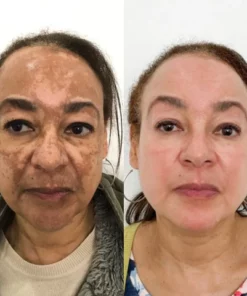 Dr.Skin™ Advanced Dark Spot Corrector & Anti-Aging Collagen Serum