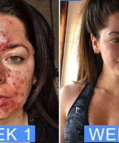 Dr.Skin™ Advanced Dark Spot Corrector & Anti-Aging Collagen Serum