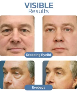 EASTMOON AWAKEN PEPTIDE LIFTING EYE GEL