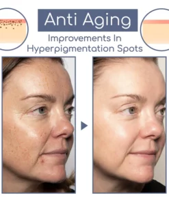 ECosmea™ Needleless Firming Mask