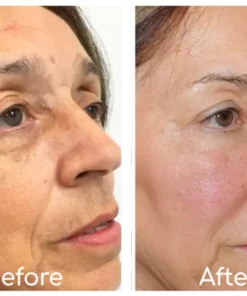 ECosmea™ Needleless Firming Mask