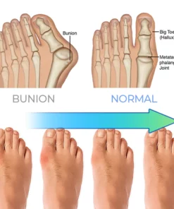 ERGOic™ Anti-Bunions Health Sock