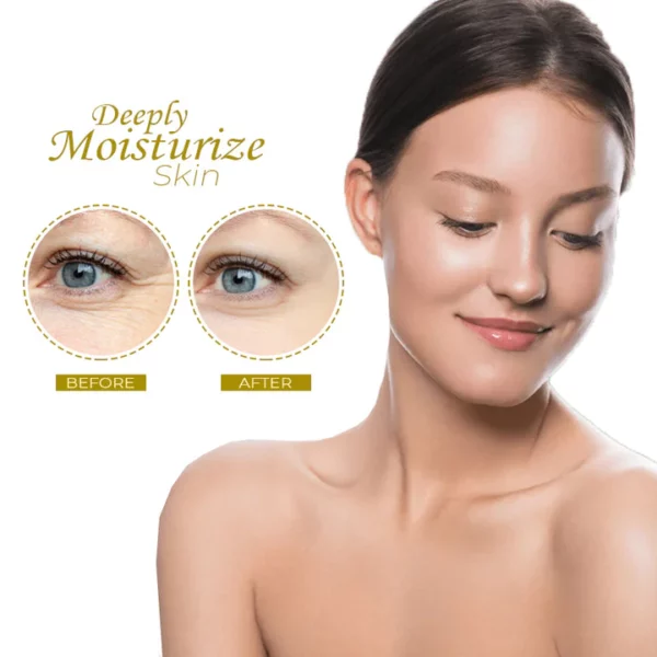 FaceLifting Koreaanse Protein ThreadLifting-set