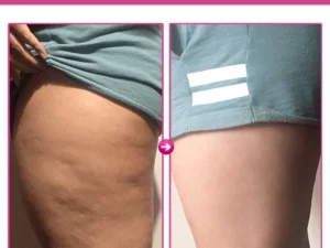 FitPlus Natural Skin Tightening Spray