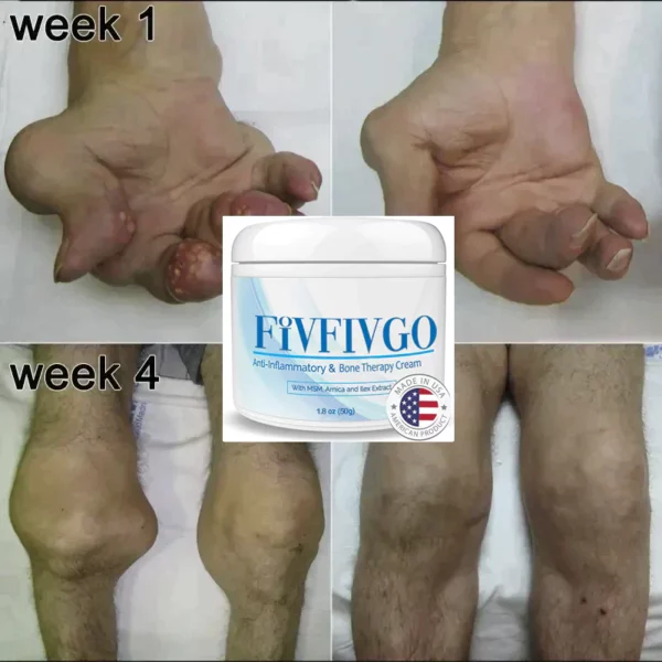 Fivfivgo™ Joint & Bone Therapy Crème