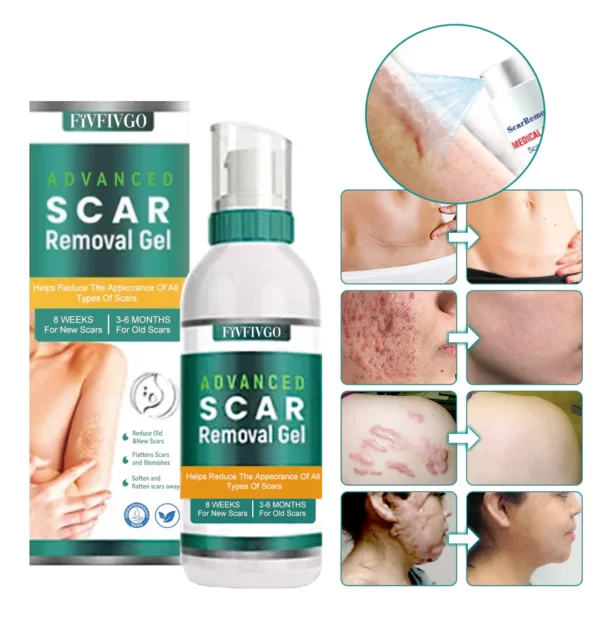 Fivfivgo™ ScarRemove Spray Advanced Scar