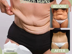 Fivfivgo™ Collagen Firming Body Cream