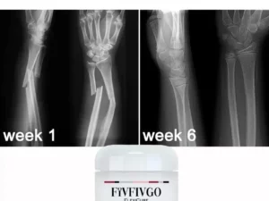 Fivfivgo™ FlexiCure Joint & Bone Therapy Cream