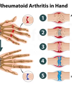 Fivfivgo™ Joint & Bone Therapy Cream
