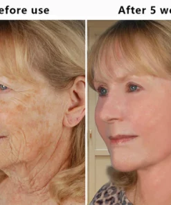 Fivfivgo™ Korean Snail Collagen Lifting & Firming Cream