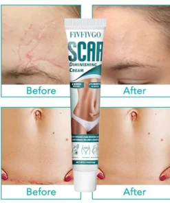 Fivfivgo™ Scar Diminishing Cream
