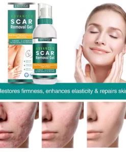 Fivfivgo™ ScarRemove Advanced Scar Spray